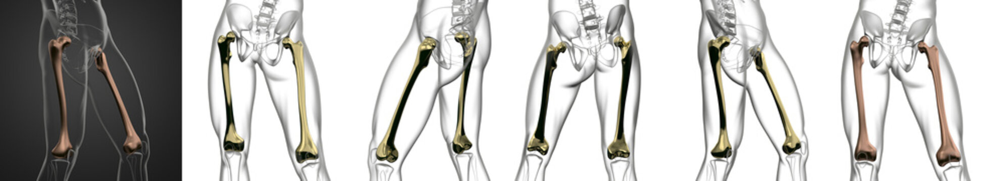 3D rendering medical illustration of the femur bone