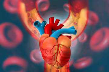 Cholesterol plaque in artery with Human heart anatomy. 3d illustration - obrazy, fototapety, plakaty