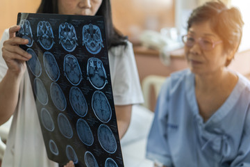 Brain disease diagnosis with medical doctor diagnosing elderly ageing patient neurodegenerative...