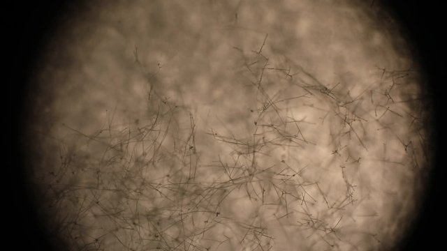 Botrytis cinerea hypae seen through an optical microscope in a microbiology labo