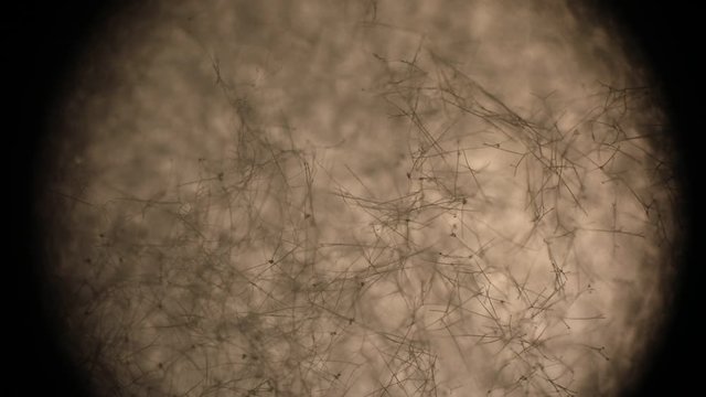 Botrytis cinerea hyphae seen under a microscope during a microbiological analysis