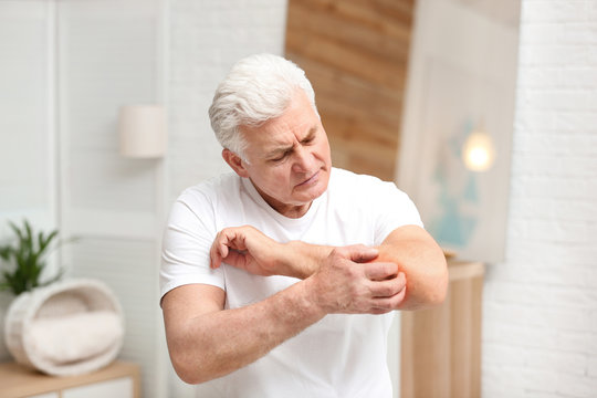Senior man scratching forearm indoors. Allergy symptom