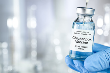 Healthcare concept with a hand in blue medical gloves holding Chicken pox, varicella-zoster virus,...