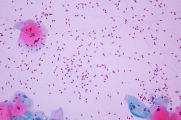 Human sperms viewed in the microscopic 600 x magnification.Spermatozoa on white background.Medical and science image concept.