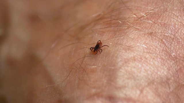 Tick Walking on Human Skin Seeking Place to Feed on Blood
