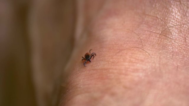 Tick Walking on Human Skin Seeking Place to Feed on Blood