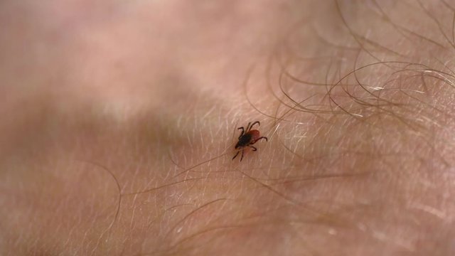 Tick Walking on Human Skin Seeking Place to Feed on Blood