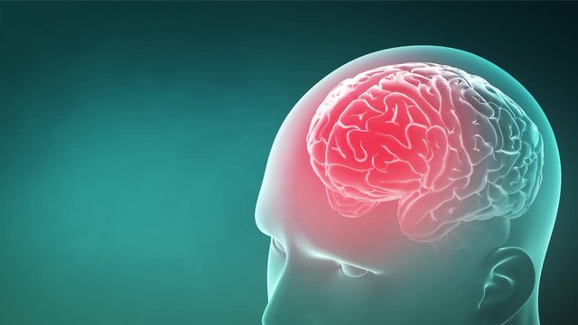 3d rendered medically animation of  human headache from tension