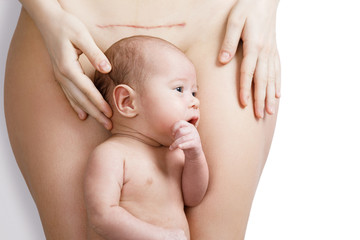 Newborn baby and his mother with a scar after C-Section on her belly