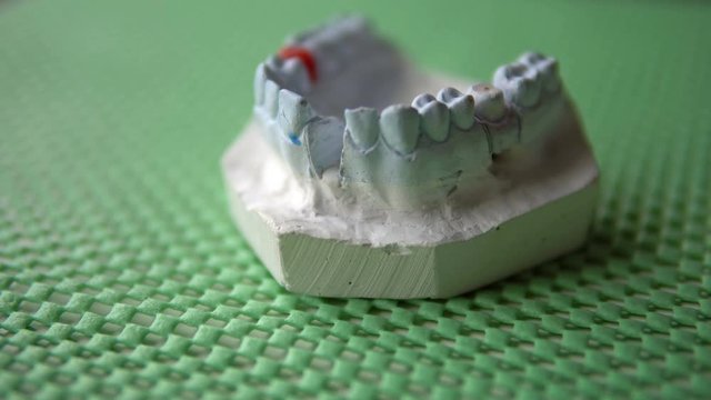 Dentist making prosthesis for a parient, dental medicine
