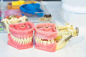 Orthodontist. The model of the jaw. Visual aid for training a dentist. Career of an orthadantist. Removable denture on the table. Workplace of a stamotologist. The desktop of a dental technician.