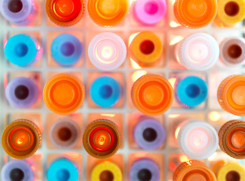 Samples in a tray in a laboratory