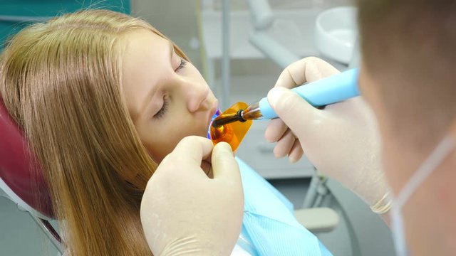 Little cute girl at dental clinic gets treatment to fill a cavity in tooth. Dental restoration and material polymerization with UV light. Shot in 4k