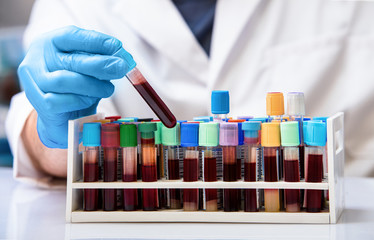 Technician working whit blood samples tubes in the blood bank / doctor with blood tubes in the...
