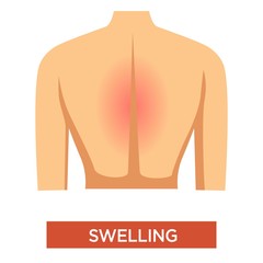Swelling in back symptom of arthritis in person