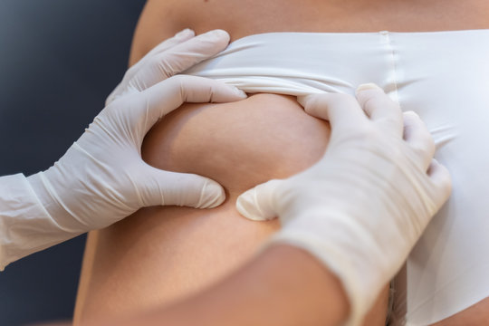 Tratamiento de eliminaci&oacute;n de grasa