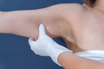 Tratamiento de eliminación de grasa