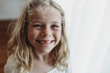 Portrait of young freckled smiling girl missing tooth