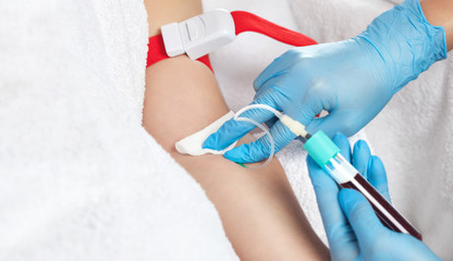 The blood tube is removed to the medical centrifuge for plasma lifting. Prp procedure and...