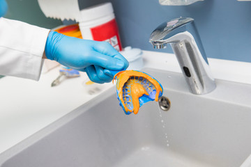 The dentist rinses the dental impression with water under pressure. Close-up of dentist's hands in...