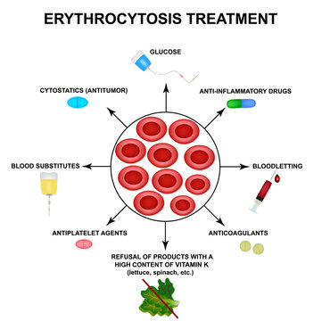 Erythrocytosis treatment. Increased red blood cells. Cells erythrocytes. Hemoglobin. The structure of red blood cells. Infographics. Vector illustration on isolated background.