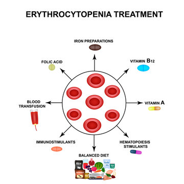 Treatment of erythrocytopenia. Reducing red blood cells. Cells erythrocytes. Hemoglobin. The structure of red blood cells. Infographics. Vector illustration on isolated background.
