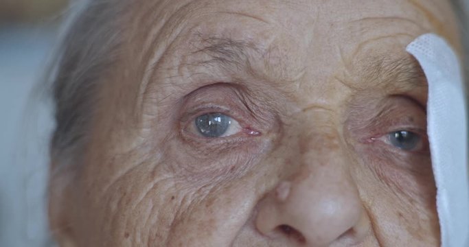 Old Lady with injured eye Cataract, Glaucoma close up