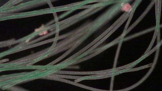 Study of Oscillatoria is a genus of filamentous cyanobacterium, oscillation in its movement under the microscope. 