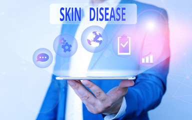 Handwriting text writing Skin Disease. Conceptual photo any of the diseases or disorders that affect the huanalysis skin Male human wear formal work suit presenting presentation using smart device