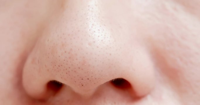 blackheads on woman nose