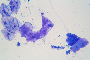 Purple colored parasites under the microscope
