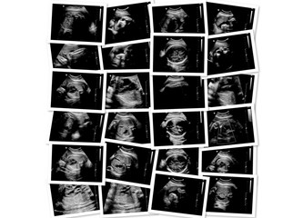 Collection of images showing 15 weeks pregnant ultrasound of baby or fetus development and pregnancy health checking