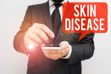 Word writing text Skin Disease. Business photo showcasing any of the diseases or disorders that affect the huanalysis skin