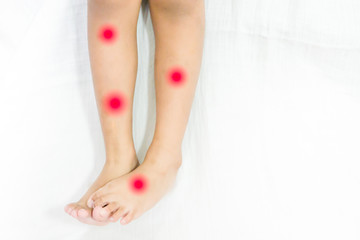 Baby skin rash and allergy with red spot cause by mosquito or insects bite on legs