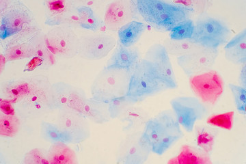 Squamous epithelial cells of human cervix under the microscope view.