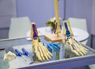Traumatology / osteosynthesis surgery bone Locking Plates system