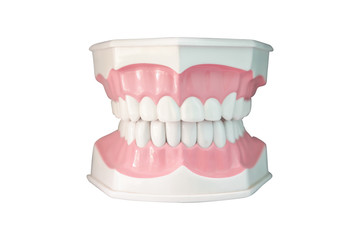 model of teeth with dental implant, closeup. Artificial teeth.Oral care and dentistry.