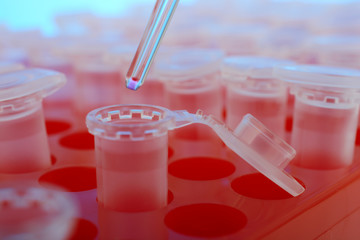 Reaction vessel in a laboratory for blood tests