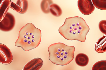 The malaria-infected red blood cells. 3D illustration showing malaria parasite Plasmodium ovale in the stage of ring-form trophozoite