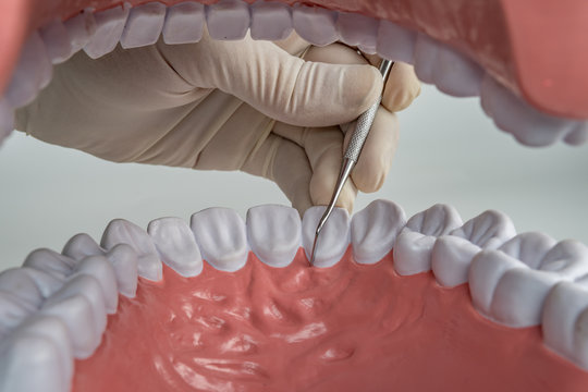 Mouth View From Inside With Dentist Hand With Gloves And Dentist Tools