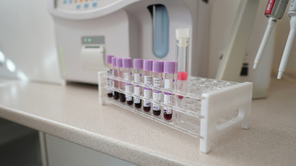 Set of test tubes close-up in laboratory in plastic box holder.