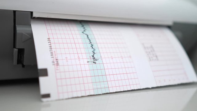 Fetal Monitoring, Medical Examination Concept.