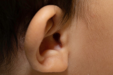 Large external ear close up, unusual earlobe shape