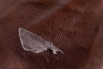 Black skinned person epidermis peeling off close up