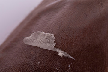 External skin layer exfoliation process, dry epidermis close up