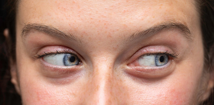 Female blue eyes looking to side close up