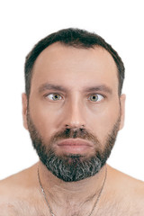 Fototapeta premium A man with strabismus. Orthoptics. ophthalmology concept. Medical desease