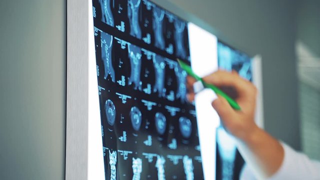 Doctor with x ray in hospital. Male doctor analyzing chest x ray in examination room