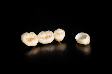 ceramic crowns of human teeth closeup macro isolate on black background. The concept of aesthetic dentistry