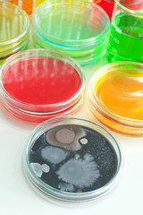 microorganism in petridish